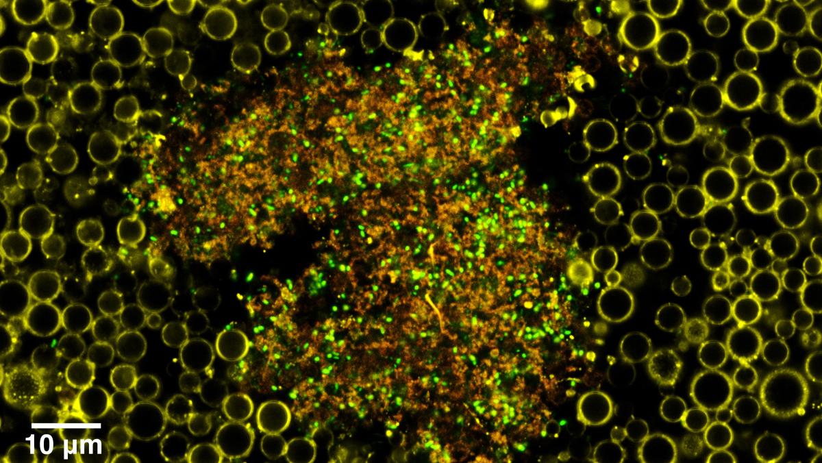 Nanobubbles under a microscope, they appear as bright yellow/green circles on a black background. A scale bar shows they are around 5 micrometers in diameter.