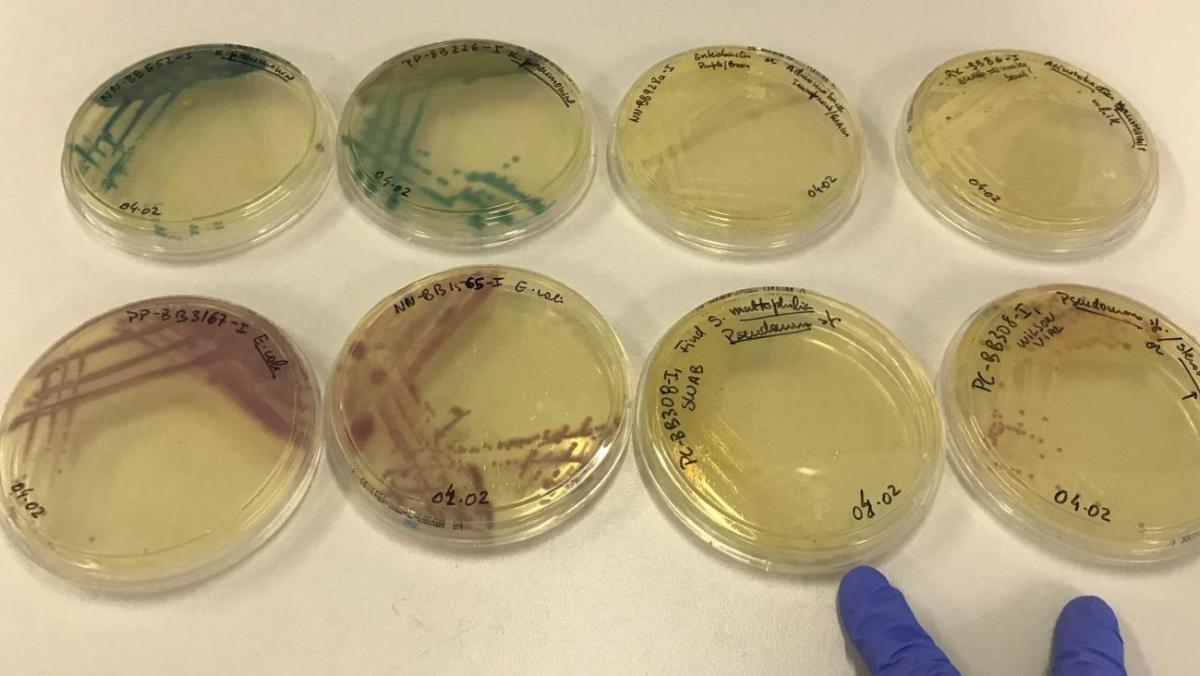 Bacterial samples in IOI's laboratory
